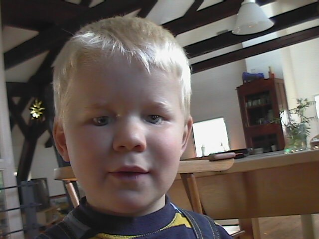 Peter mit Glasprothesen